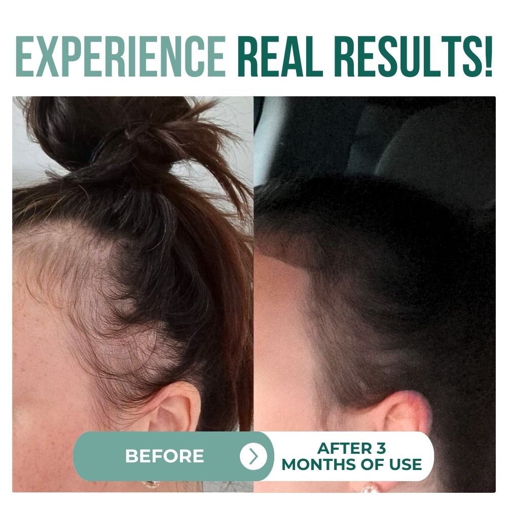 100% Organic Batana oil for Hair Growth | Pure Elaeis Oleifera